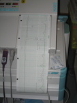 A view of the fetal heart rate and contraction monitor.